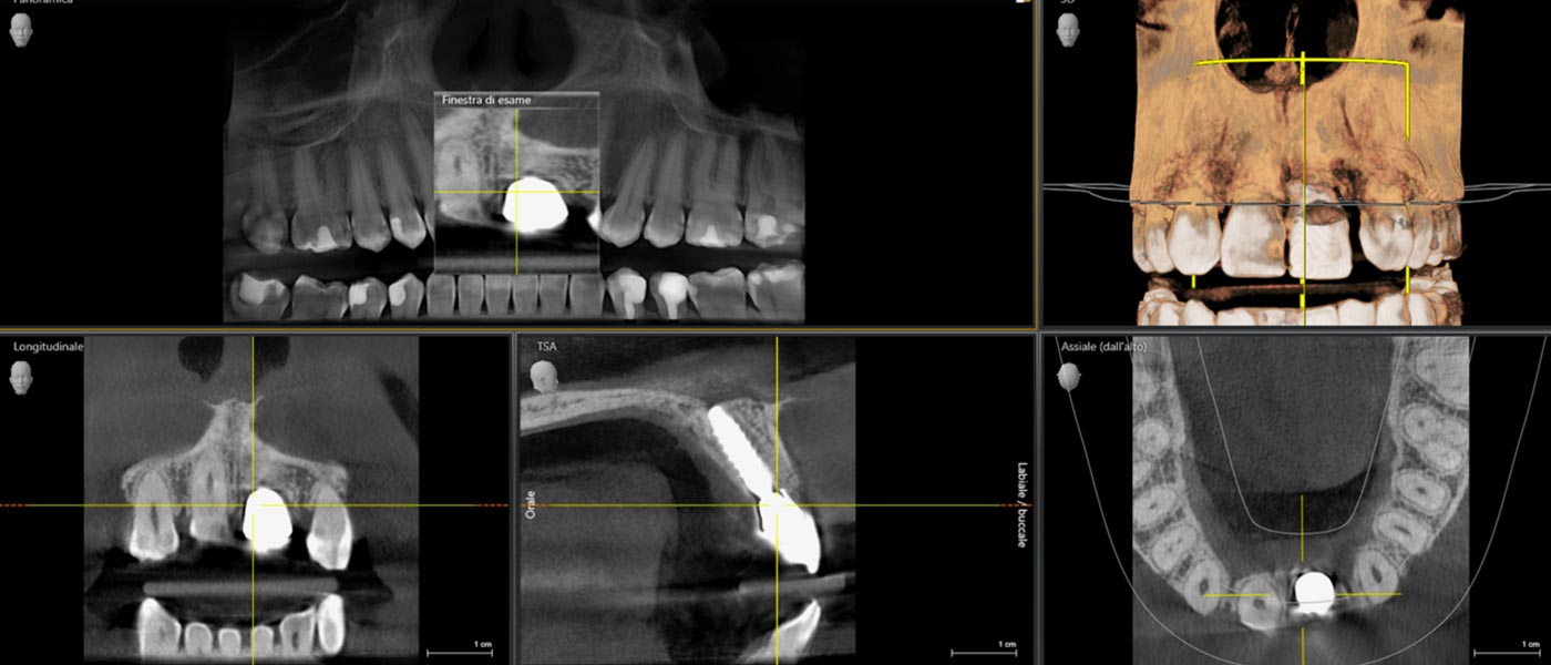 Una radiologia digitale presso lo Studio medico odontoiatrico Pellitteri a Bolzano